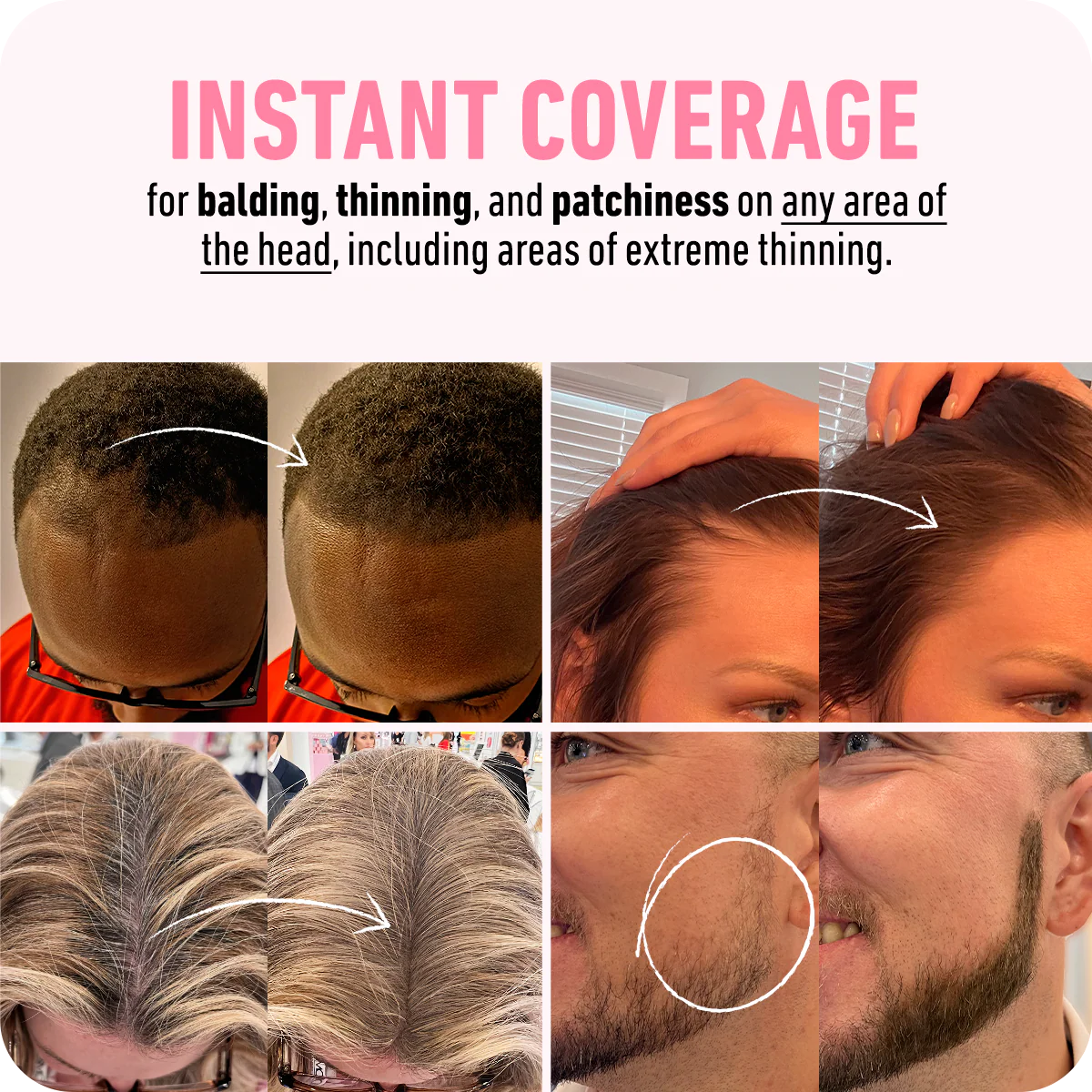 🔥LAST DAY 50% OFF - 🎅Hairline Coverage Powder – Instant 48-Hour Scalp & Root Concealer! ✨