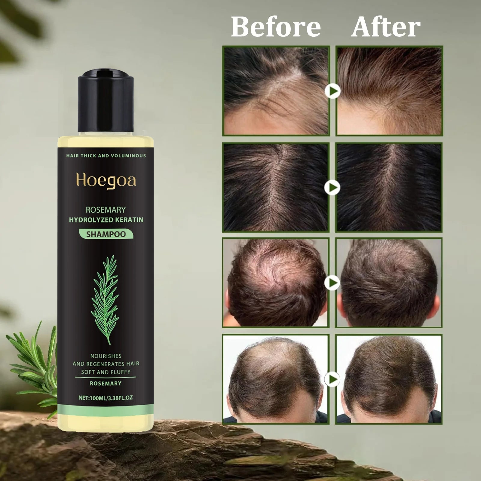 🔥LAST DAY 50% OFF - 🎅HOEGOA Organic Rosemary Hair Growth Shampoo & Hair Conditioner