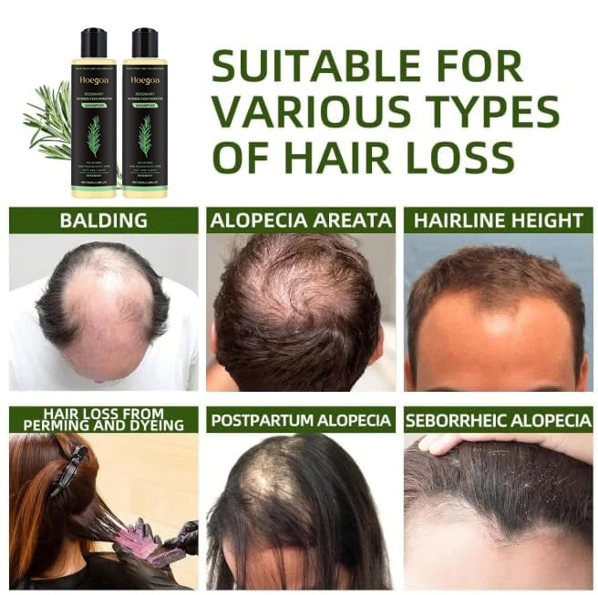 🔥LAST DAY 50% OFF - 🎅HOEGOA Organic Rosemary Hair Growth Shampoo & Hair Conditioner